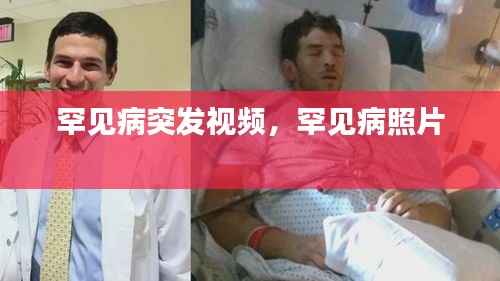 罕见病突发视频，罕见病照片 