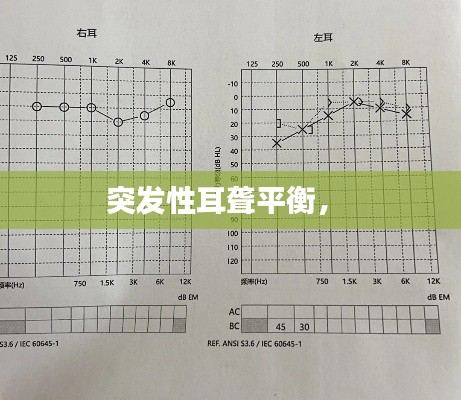 突发性耳聋平衡,